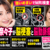 藤崎奈々子が無症候性脳梗塞と未破裂脳動脈瘤を明かしたニュースのイメージ画像