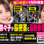 藤崎奈々子が無症候性脳梗塞と未破裂脳動脈瘤を明かしたニュースのイメージ画像